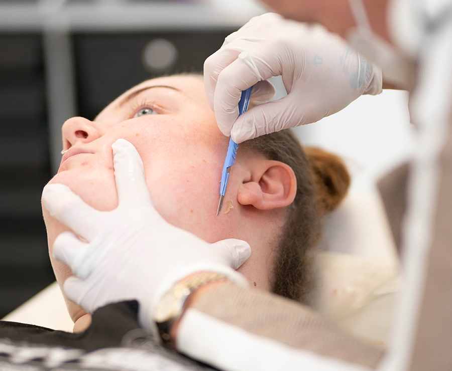 dermaplane-cheek dermaplane-cheek