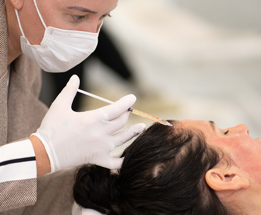 hair-filler-prp hair-filler-prp