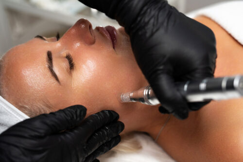 microneedling-courses