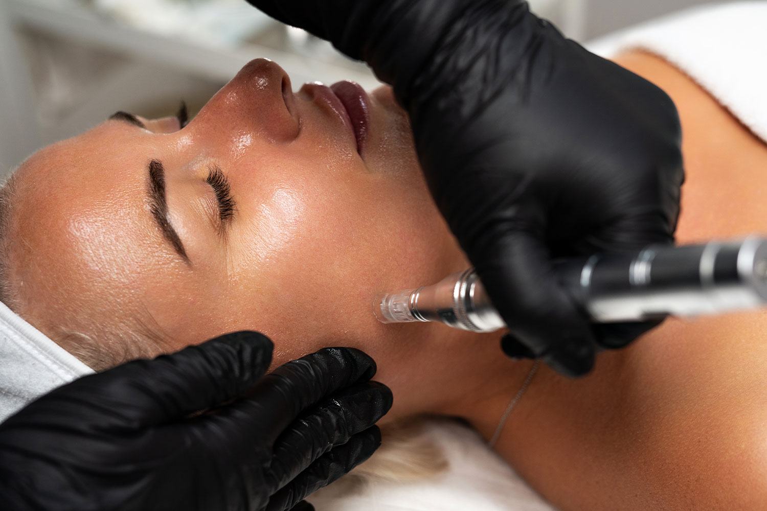 microneedling-courses