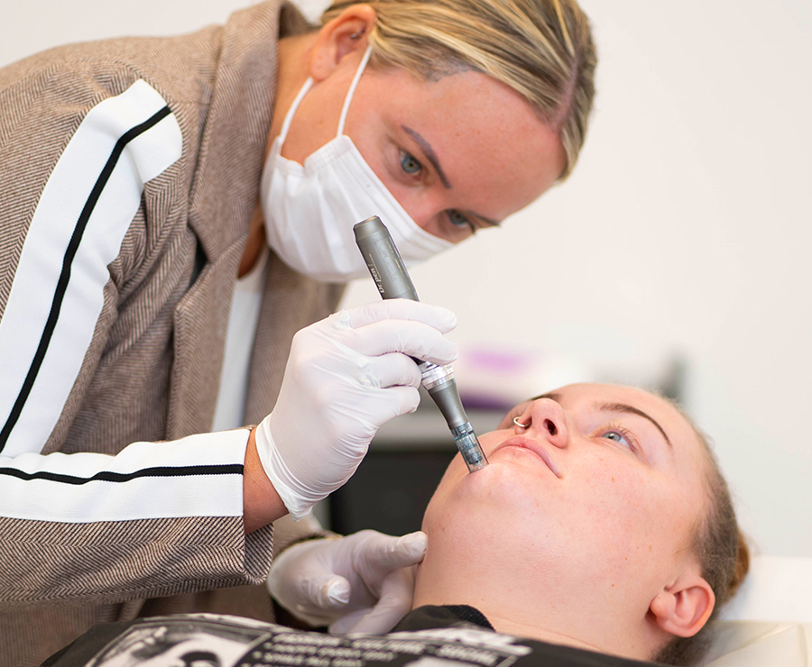 microneedling-face microneedling-face