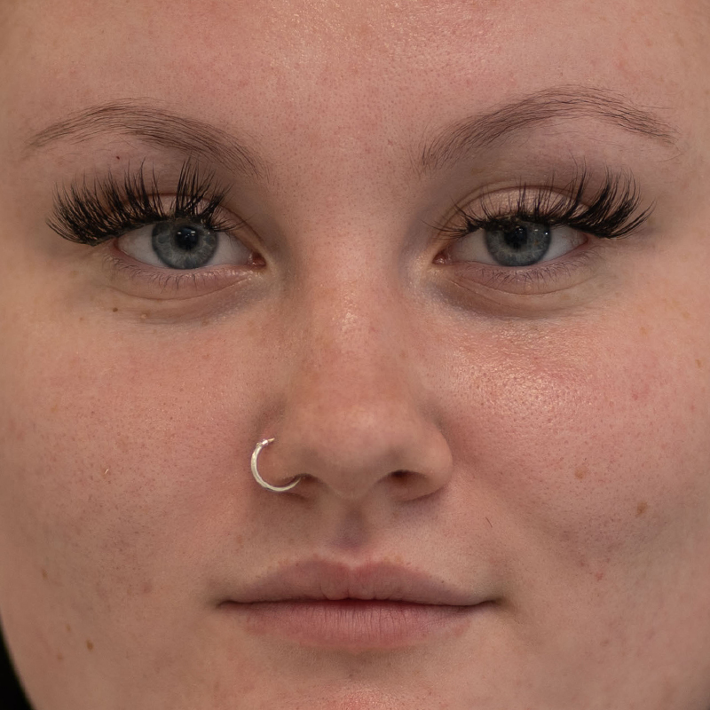 semi-permanent-powder-ombre-brows-before