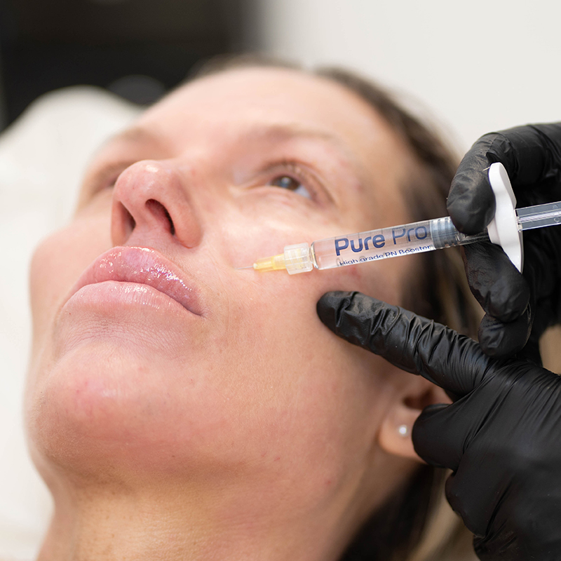 skin-boosters-pure-pro skin-boosters-pure-pro