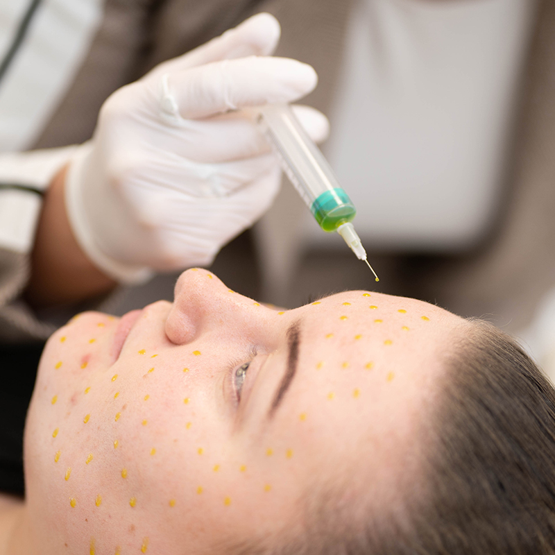 skin-peels-biorepeel skin-peels-biorepeel